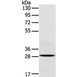 TREM2 Antibody from Signalway Antibody (40390) - Antibodies.com