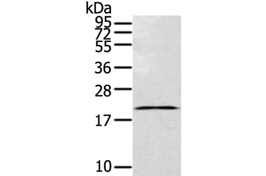 TEX37 Antibody from Signalway Antibody (40395) - Antibodies.com