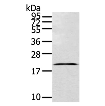 TEX37 Antibody from Signalway Antibody (40395) - Antibodies.com