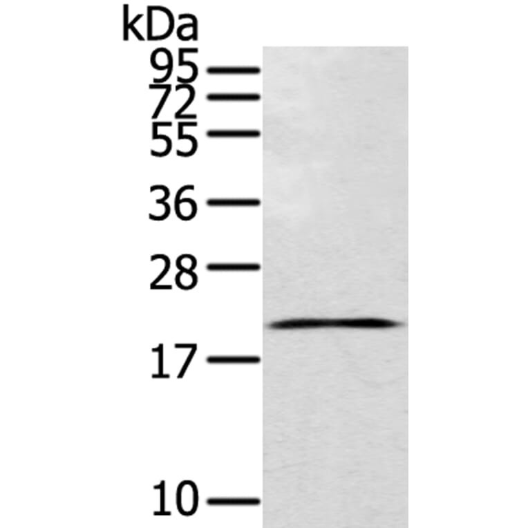 TEX37 Antibody from Signalway Antibody (40395) - Antibodies.com