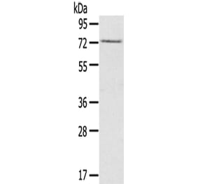 RAD17 Antibody from Signalway Antibody (42728) - Antibodies.com