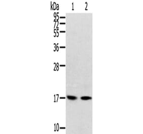 RPLP1 Antibody from Signalway Antibody (42742) - Antibodies.com