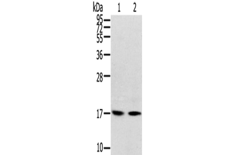 RPLP1 Antibody from Signalway Antibody (42742) - Antibodies.com