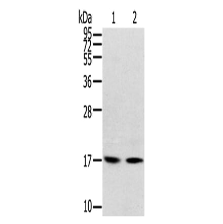 RPLP1 Antibody from Signalway Antibody (42742) - Antibodies.com