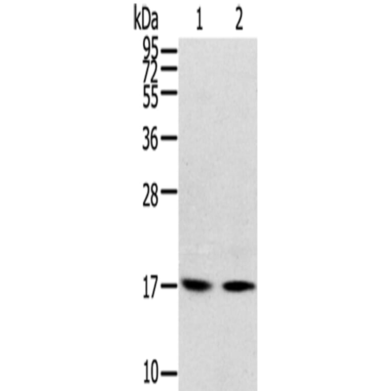 RPLP1 Antibody from Signalway Antibody (42742) - Antibodies.com