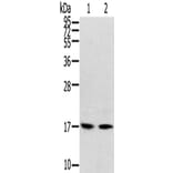 RPLP1 Antibody from Signalway Antibody (42742) - Antibodies.com