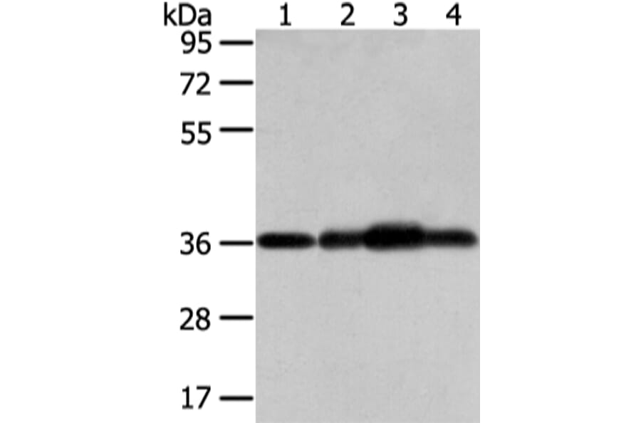 STX12 Antibody from Signalway Antibody (42771) - Antibodies.com