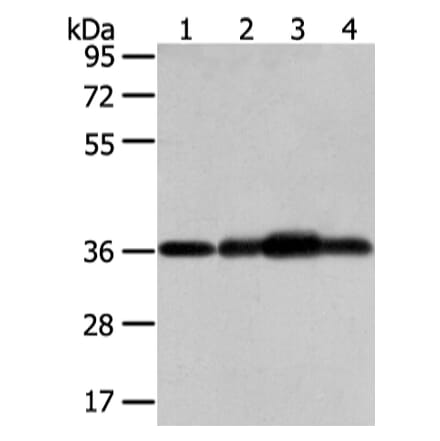 STX12 Antibody from Signalway Antibody (42771) - Antibodies.com