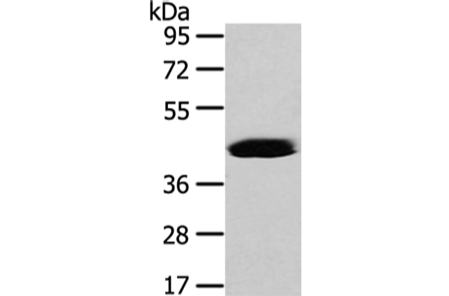 VASH2 Antibody from Signalway Antibody (42828) - Antibodies.com