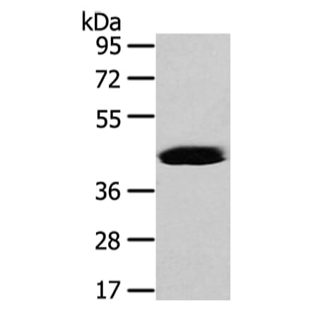 VASH2 Antibody from Signalway Antibody (42828) - Antibodies.com