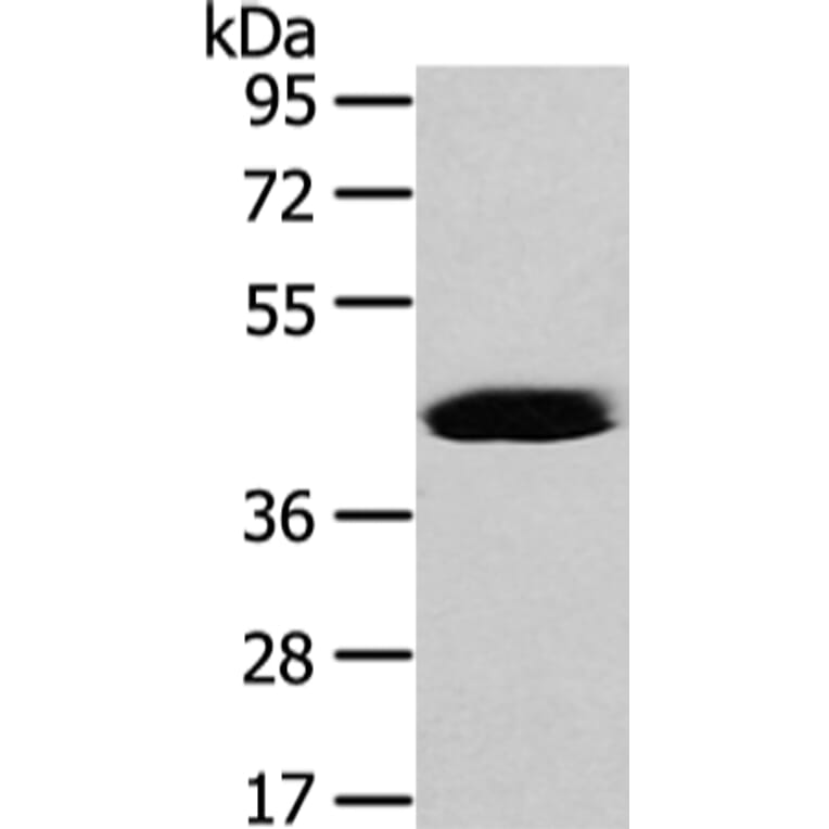 VASH2 Antibody from Signalway Antibody (42828) - Antibodies.com