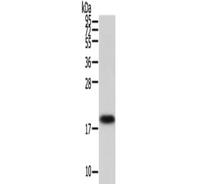 VPS25 Antibody from Signalway Antibody (42837) - Antibodies.com