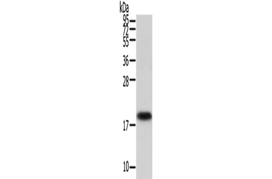 VPS25 Antibody from Signalway Antibody (42837) - Antibodies.com