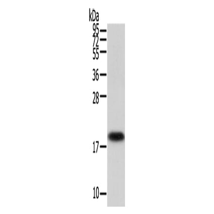 VPS25 Antibody from Signalway Antibody (42837) - Antibodies.com