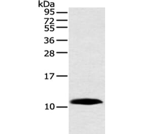HMGN3 Antibody from Signalway Antibody (42888) - Antibodies.com