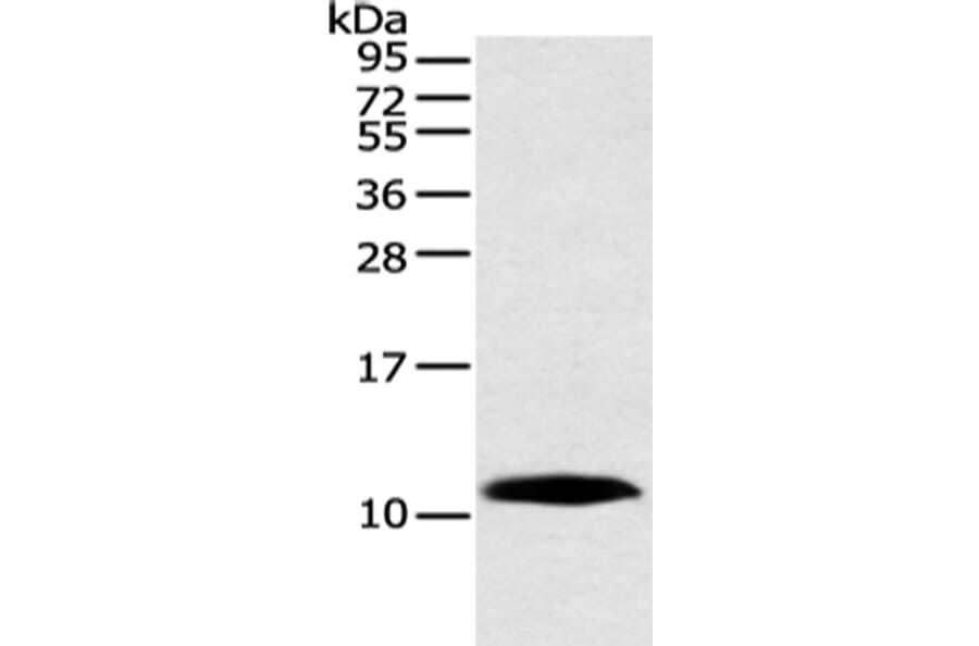 HMGN3 Antibody from Signalway Antibody (42888) - Antibodies.com