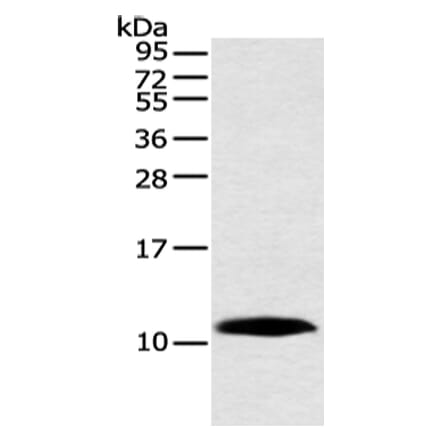 HMGN3 Antibody from Signalway Antibody (42888) - Antibodies.com