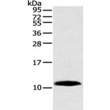 HMGN3 Antibody from Signalway Antibody (42888) - Antibodies.com