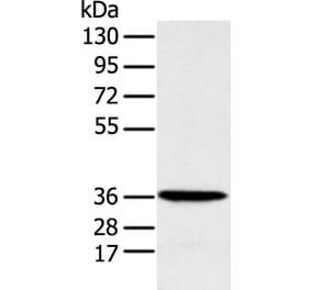 MAT2B Antibody from Signalway Antibody (42910) - Antibodies.com
