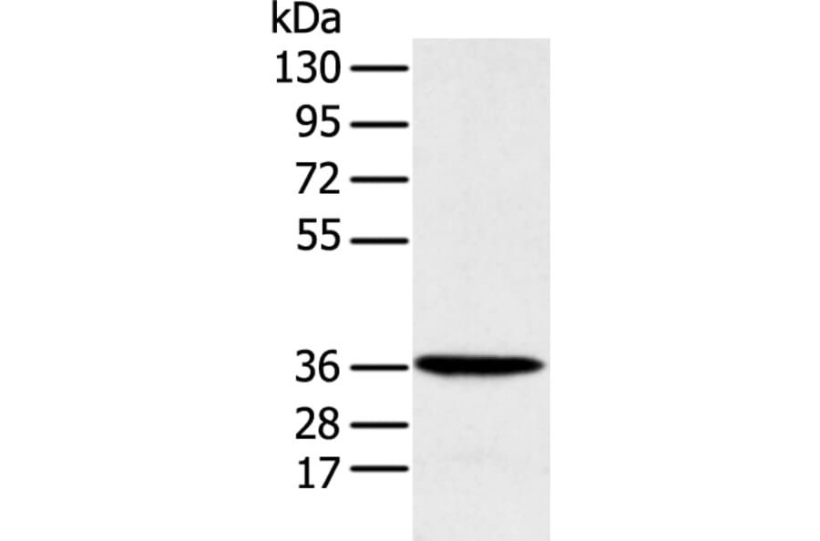 MAT2B Antibody from Signalway Antibody (42910) - Antibodies.com