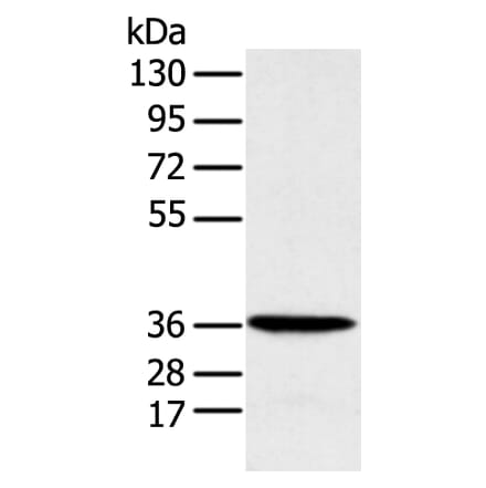 MAT2B Antibody from Signalway Antibody (42910) - Antibodies.com