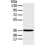 MAT2B Antibody from Signalway Antibody (42910) - Antibodies.com