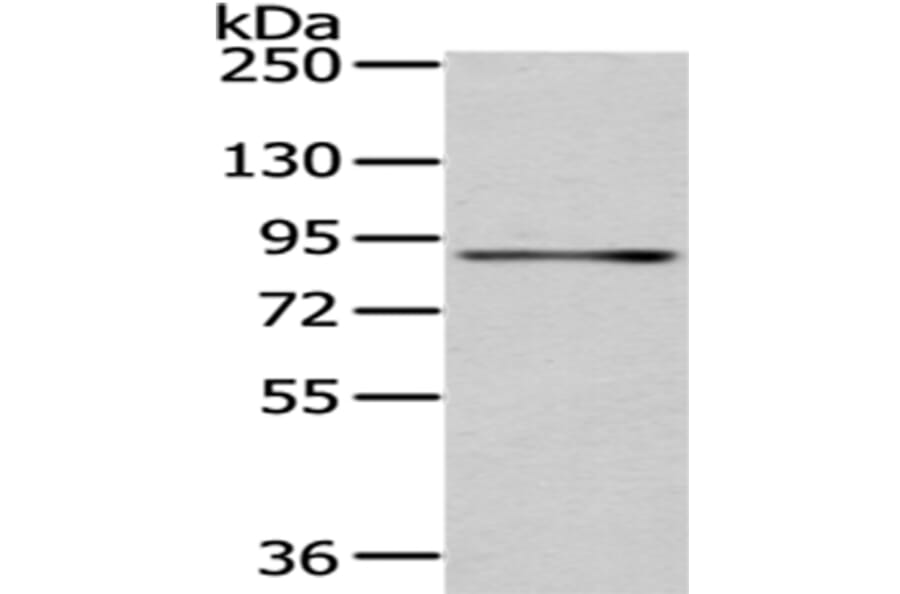 SSRP1 Antibody from Signalway Antibody (43058) - Antibodies.com