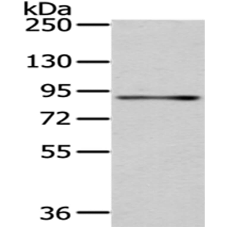 SSRP1 Antibody from Signalway Antibody (43058) - Antibodies.com