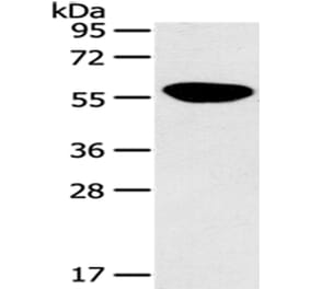 PINK1 Antibody from Signalway Antibody (43104) - Antibodies.com