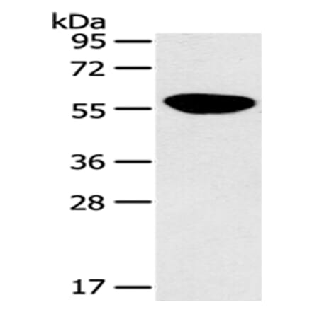 PINK1 Antibody from Signalway Antibody (43104) - Antibodies.com
