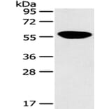 PINK1 Antibody from Signalway Antibody (43104) - Antibodies.com