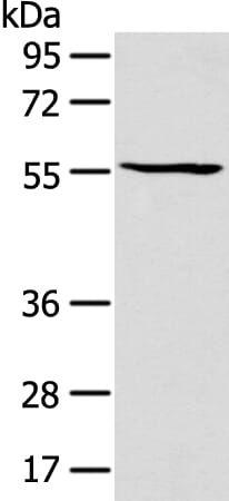 Gel: 8% SDS-PAGE Lysate: 40 &#956;g Lane: Mouse lung tissue Primary antibody: 1/200 dilution Secondary antibody: Goat anti rabbit IgG at 1/8000 dilution Exposure time: 30 seconds