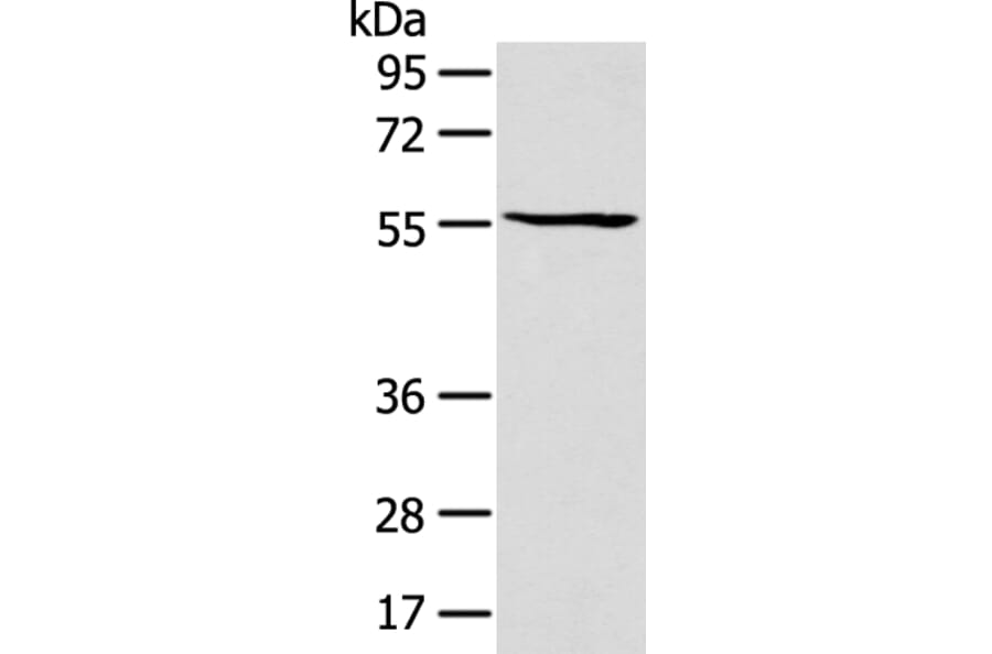 PTGIS Antibody from Signalway Antibody (43129) - Antibodies.com