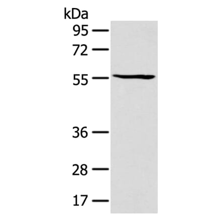 PTGIS Antibody from Signalway Antibody (43129) - Antibodies.com