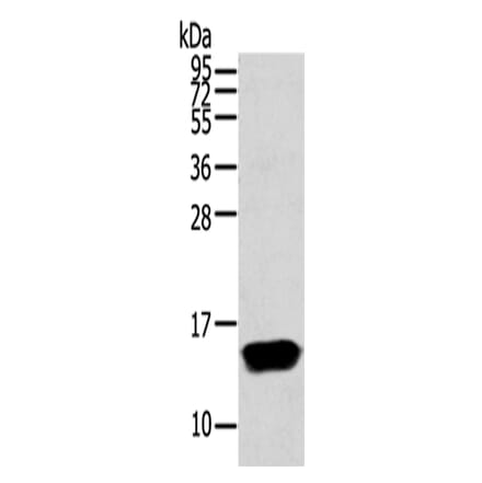 FABP1 Antibody from Signalway Antibody (43132) - Antibodies.com