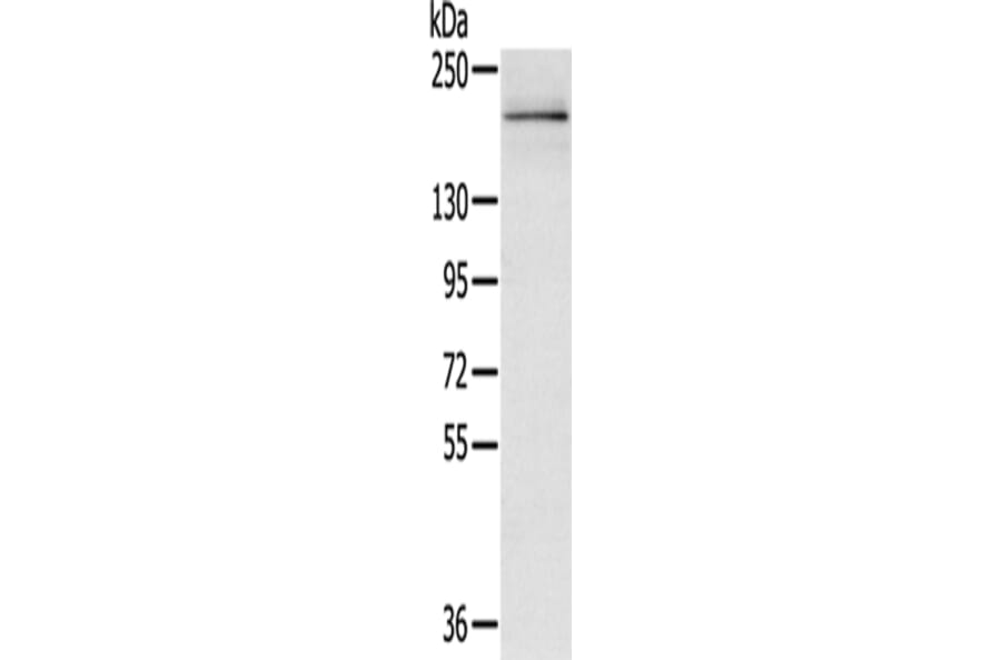 RGS12 Antibody from Signalway Antibody (43141) - Antibodies.com