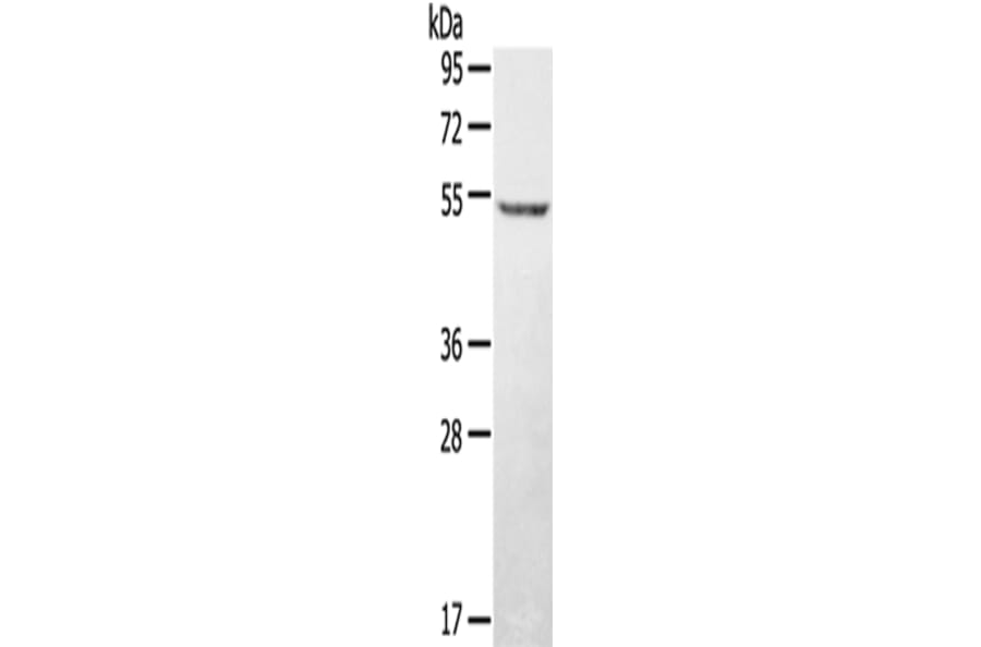 STYK1 Antibody from Signalway Antibody (43150) - Antibodies.com