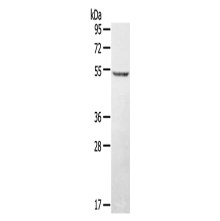 STYK1 Antibody from Signalway Antibody (43150) - Antibodies.com