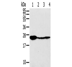 TPD52 Antibody from Signalway Antibody (43166) - Antibodies.com
