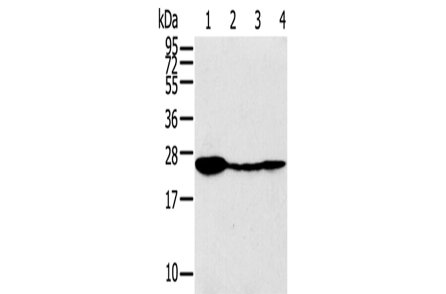 TPD52 Antibody from Signalway Antibody (43166) - Antibodies.com