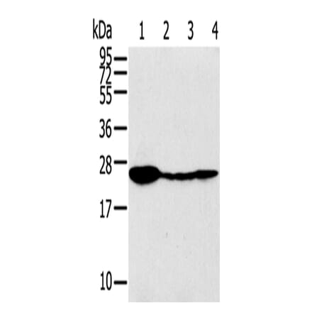 TPD52 Antibody from Signalway Antibody (43166) - Antibodies.com