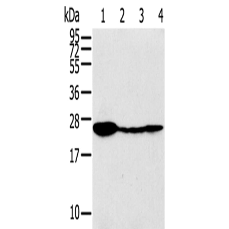 TPD52 Antibody from Signalway Antibody (43166) - Antibodies.com