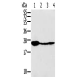TPD52 Antibody from Signalway Antibody (43166) - Antibodies.com