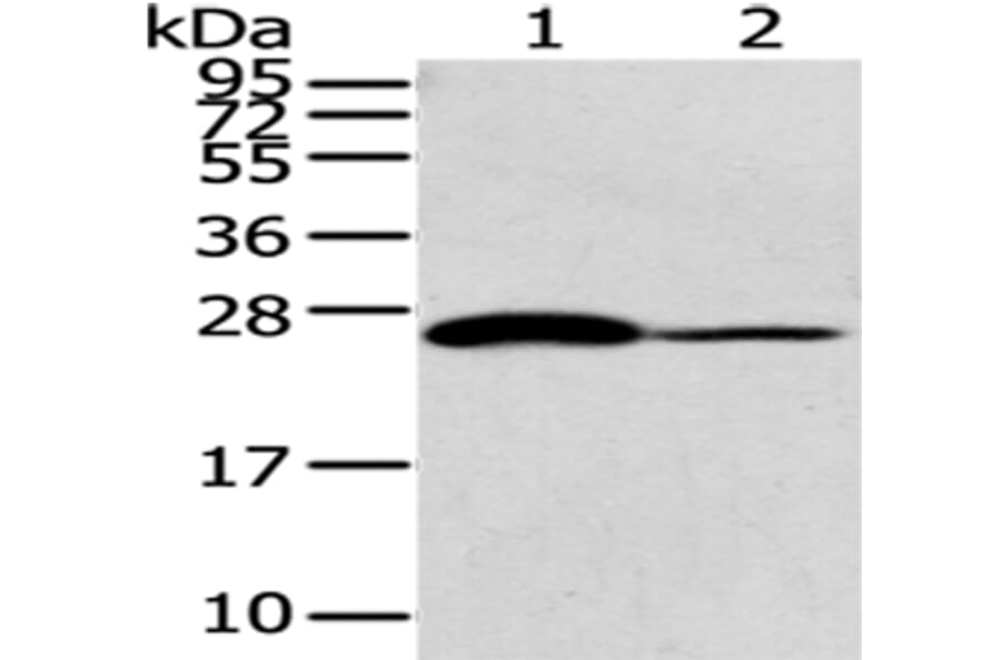 CD79A Antibody from Signalway Antibody (43185) - Antibodies.com