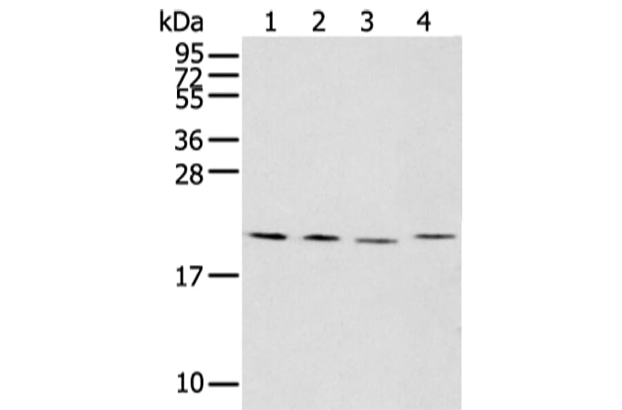 KLRC2 Antibody from Signalway Antibody (43309) - Antibodies.com