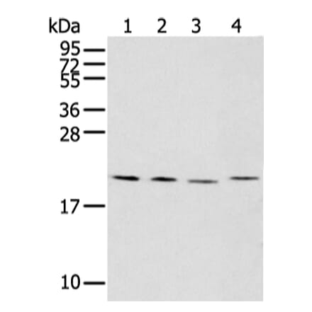 KLRC2 Antibody from Signalway Antibody (43309) - Antibodies.com