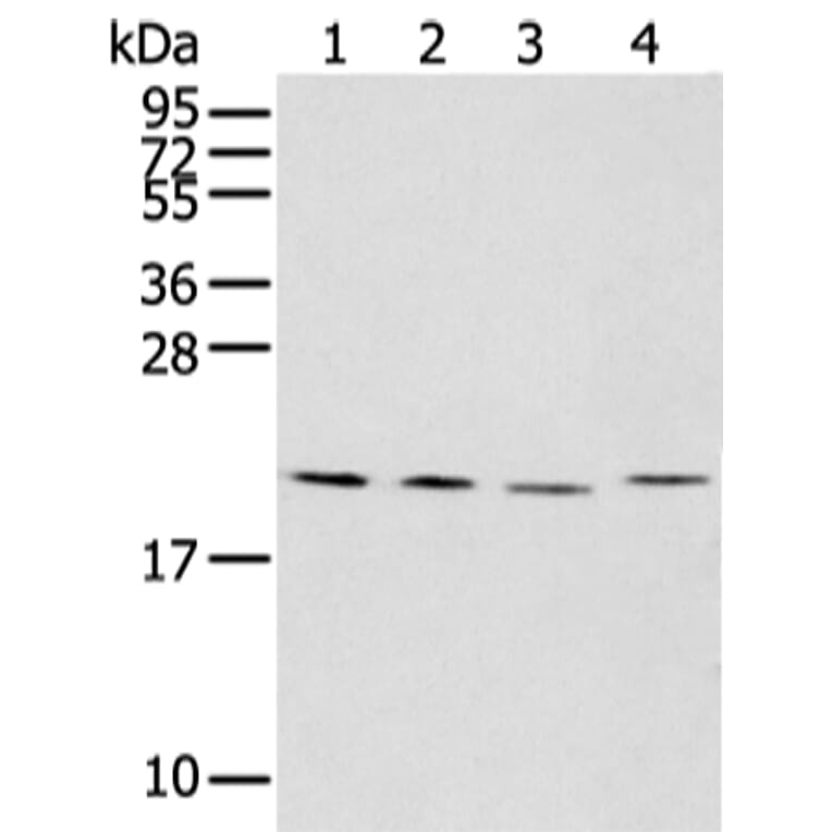 KLRC2 Antibody from Signalway Antibody (43309) - Antibodies.com