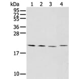 KLRC2 Antibody from Signalway Antibody (43309) - Antibodies.com