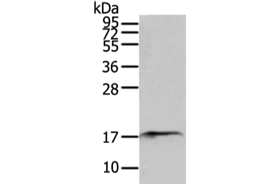 SNX12 Antibody from Signalway Antibody (43331) - Antibodies.com