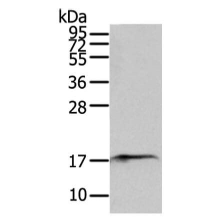 SNX12 Antibody from Signalway Antibody (43331) - Antibodies.com